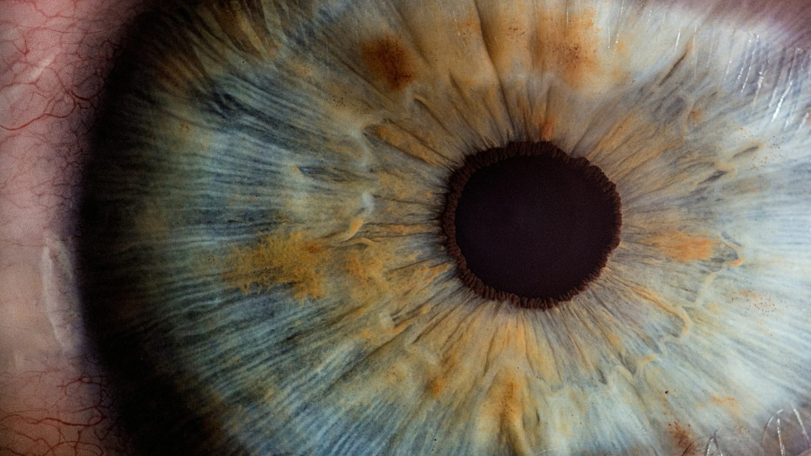 03 Fisiologia do olho